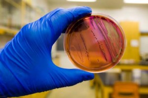 Czy powinniśmy się obawiać EHEC czyli zatrucia bakterią E. Coli?